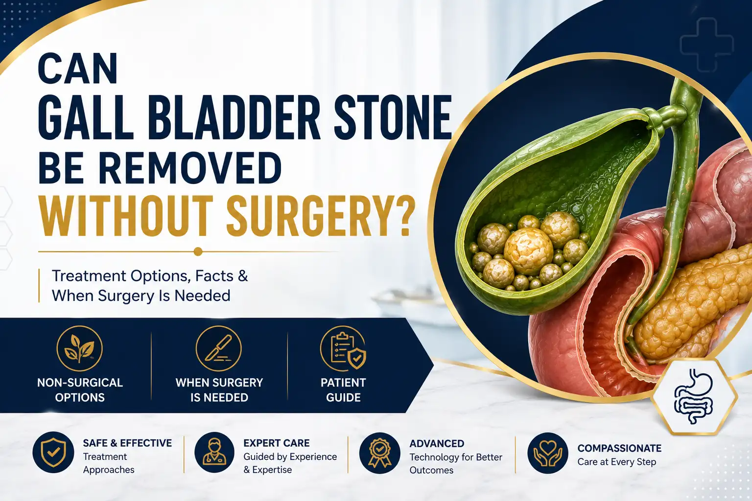 Can gall bladder stone be removed without surgery treatment options and when surgery is needed